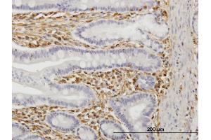 Immunoperoxidase of monoclonal antibody to TRIM16 on formalin-fixed paraffin-embedded human small Intestine. (TRIM16 Antikörper  (AA 165-273))