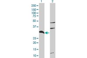 Western Blot analysis of TNFAIP6 expression in transfected 293T cell line ( H00007130-T01 ) by TNFAIP6 MaxPab polyclonal antibody. (TNFAIP6 Antikörper  (AA 1-277))