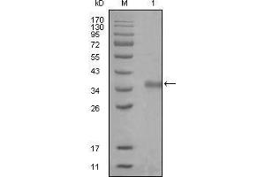 Western blot analysis using NCOR1 mouse mAb against truncated Trx-NCOR1 recombinant protein (1).