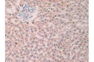 IHC-P analysis of Rat Liver Tissue, with DAB staining. (SLIT1 Antikörper  (AA 308-512))