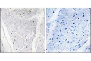 Immunohistochemistry analysis of paraffin-embedded human heart , using ALPK2 Antibody. (ALPK2 Antikörper  (AA 1741-1790))