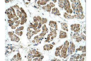 RHOT1 antibody was used for immunohistochemistry at a concentration of 4-8 ug/ml. (RHOT1 Antikörper  (N-Term))