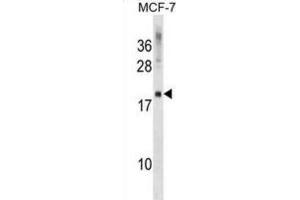 Western Blotting (WB) image for anti-CKLF-Like MARVEL Transmembrane Domain Containing 5 (CMTM5) antibody (ABIN2999517) (CMTM5 Antikörper)