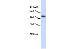 B4GALNT3 antibody used at 1 ug/ml to detect target protein. (B4GALNT3 Antikörper  (N-Term))