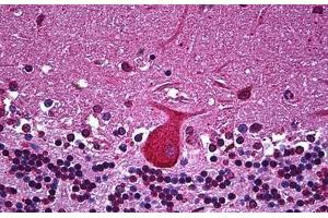 Human Brain, Cerebellum: Formalin-Fixed, Paraffin-Embedded (FFPE) (TNF alpha Antikörper  (AA 1-234))