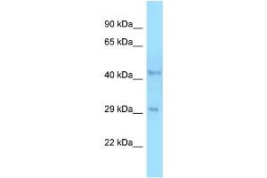 WB Suggested Anti-B4galt3 Antibody   Titration: 1.