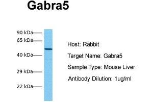 Host: Rabbit Target Name: Gabra5 Sample Tissue: Mouse Liver Antibody Dilution: 1. (GABRA5 Antikörper  (Middle Region))