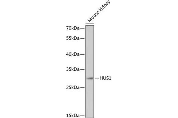 HUS1 抗体  (AA 1-280)