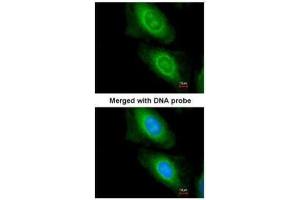 Immunofluorescence (IF) image for anti-Malonyl CoA Decarboxylase (MLYCD) antibody (ABIN2856728)