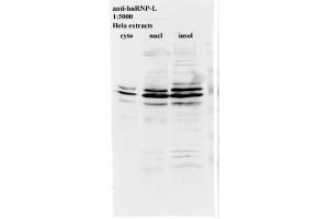 Image no. 2 for anti-Heterogeneous Nuclear Ribonucleoprotein L (HNRNPL) antibody (ABIN108589) (HNRNPL Antikörper)