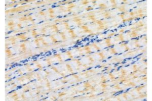 ABIN6266160 and ABIN6277132 at 1/100 staining Rat muscle tissue by IHC-P. (EIF2C3 Antikörper  (Internal Region))