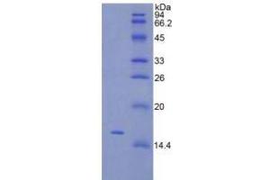 SDS-PAGE analysis of Rat TSLP Protein.