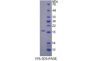 SDS-PAGE analysis of Human DARS Protein. (DARS Protein)