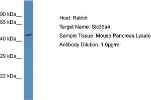 Host: Rabbit Target Name: SLC36A4 Sample Tissue: Mouse Pancreas Antibody Dilution: 1ug/ml (SLC36A4 Antikörper  (N-Term))