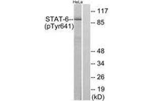 Western blot analysis of extracts from HeLa cells treated with IL-4, using STAT6 (Phospho-Tyr641) Antibody. (STAT6 Antikörper  (pTyr641))