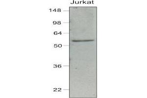 Western Blotting (WB) image for anti-Interferon Regulatory Factor 7 (IRF7) (AA 1-150), (N-Term) antibody (ABIN263914)