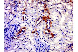 Paraformaldehyde-fixed, paraffin embedded rat kidney, Antigen retrieval by boiling in sodium citrate buffer (pH6. (IGSF21 Antikörper  (AA 90-140))