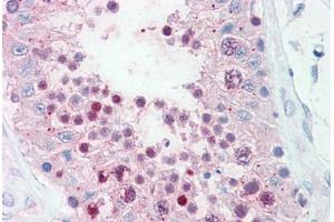 Anti-SLITRK6 antibody  ABIN960818 IHC staining of human testis. (SLITRK6 Antikörper  (Cytoplasmic Domain))