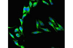 Immunofluorescent analysis of Hela cells using ABIN7158234 at dilution of 1:100 and Alexa Fluor 488-congugated AffiniPure Goat Anti-Rabbit IgG(H+L) (CD37 Antikörper  (AA 109-237))