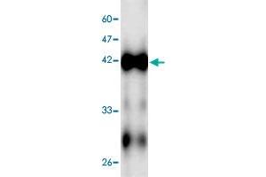 Western blot analysis in ECs2841 recombinant protein with ECs2841 monoclonal antibody, clone 5f4s6  at 1 : 1000 dilution. (ECs2841 Antikörper  (AA 23-338))