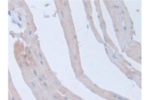 Immunohistochemistry (IHC) image for anti-Intersectin 1 (ITSN1) (AA 1-227) antibody (ABIN7444238)