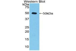 Western Blotting (WB) image for anti-Dishevelled, Dsh Homolog 3 (Drosophila) (DVL3) (AA 545-716) antibody (ABIN1858676)