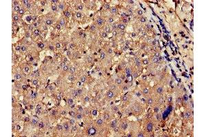 Immunohistochemistry of paraffin-embedded human liver tissue using ABIN7148445 at dilution of 1:100 (CNKSR2 Antikörper  (AA 650-800))