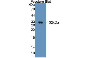 Western blot analysis of recombinant Rat SHP. (NR0B2 Antikörper  (AA 1-260))