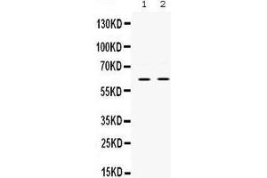 Western blot analysis of PAK3 expression in rat brain extract (lane 1) and mouse brain extract (lane 2). (PAK3 Antikörper  (N-Term))