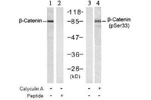 Image no. 3 for anti-Catenin (Cadherin-Associated Protein), beta 1, 88kDa (CTNNB1) (pSer33) antibody (ABIN196957) (CTNNB1 Antikörper  (pSer33))