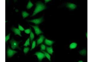 Immunofluorescent staining of HeLa cells using anti-ILVBL mouse monoclonal antibody (ABIN2454750). (ILVBL Antikörper)