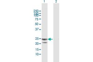 Western Blot analysis of ATP5O expression in transfected 293T cell line by ATP5O MaxPab polyclonal antibody. (ATP5O Antikörper  (AA 1-213))