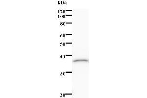 Western Blotting (WB) image for anti-ALX Homeobox 1 (ALX1) antibody (ABIN931200) (ALX1 Antikörper)