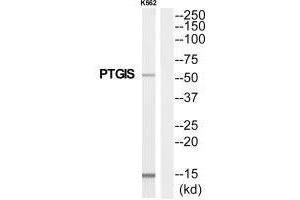 Western blot analysis of extracts from K562 cells, using PTGIS antibody. (PTGIS Antikörper)