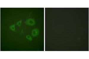 Immunofluorescence analysis of HuvEc cells, using Trk B (Phospho-Tyr705) Antibody. (TRKB Antikörper  (pTyr706))
