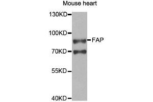 Western blot analysis of extracts of Mouse heart cell line, using FAP antibody. (FAP Antikörper)