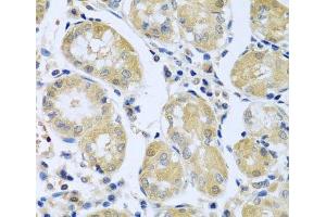 Immunohistochemistry of paraffin-embedded Human stomach using FBXL5 Polyclonal Antibody at dilution of 1:100 (40x lens). (FBXL5 Antikörper)