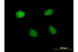 Immunofluorescence of monoclonal antibody to HEY1 on HeLa cell. (HEY1 Antikörper  (AA 121-220))