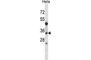 Western blot analysis in Hela cell line lysates (35ug/lane) using LAT2 / WBSCR15  Antibody .
