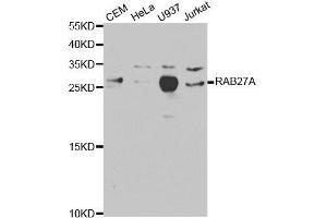 Western blot analysis of extracts of various cell lines, using RAB27A antibody. (RAB27A Antikörper  (AA 1-221))