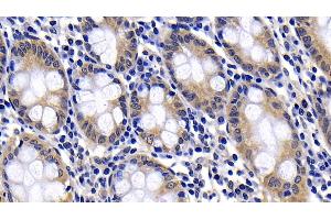 Detection of BAD in Human Colon Tissue using Polyclonal Antibody to Bcl2 Associated Death Promoter (BAD)