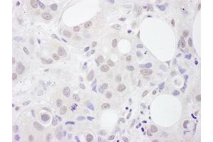 Immunohistochemistry (IHC) image for anti-U2 Small Nuclear RNA Auxiliary Factor 2 (U2AF59) (AA 430-475) antibody (ABIN7454940)