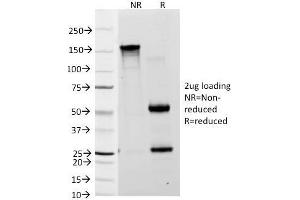 SDS-PAGE Analysis Purified Lewis A Monoclonal Antibody (7LE). (Blood Group Lewis A Antikörper)