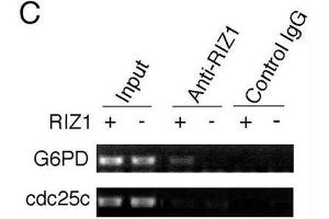 Image no. 3 for anti-PR Domain Containing 2, with ZNF Domain (PRDM2) antibody (ABIN2995299) (PRDM2 Antikörper)