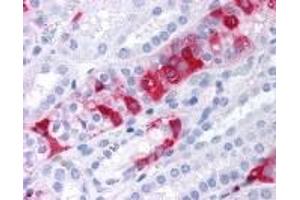 Immunohistochemistry (IHC) image for anti-serum/glucocorticoid Regulated Kinase Family, Member 3 (SGK3) (C-Term) antibody (ABIN2469462)