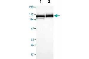 Western Blot analysis of Lane 1: RT-4 and Lane 2: U-251MG sp cell lysates with MCM4 polyclonal antibody . (MCM4 Antikörper)