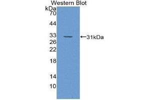 Western Blotting (WB) image for anti-Glutathione S-Transferase theta 1 (GSTT1) (AA 7-240) antibody (ABIN1868284) (GSTT1 Antikörper  (AA 7-240))