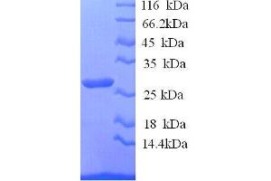 Interleukin 12b (IL12B) (AA 23-327), (full length) protein (His tag) (IL12B Protein (AA 23-327, full length) (His tag))