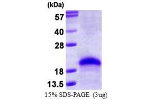 Image no. 1 for VEGF 165 protein (ABIN1098802)