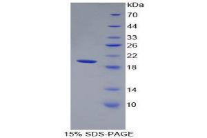 SDS-PAGE (SDS) image for Matrix Metallopeptidase 9 (Gelatinase B, 92kDa Gelatinase, 92kDa Type IV Collagenase) (MMP9) (AA 225-413) protein (His tag) (ABIN1980762)